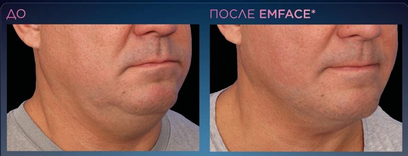 emface_ppt_submentum-product-presentation_ru100-3-800x307.jpg